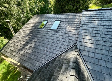 Shingles Shingles